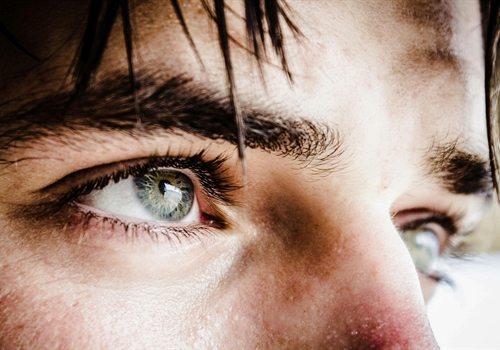 Underlying causes of wrinkled skin